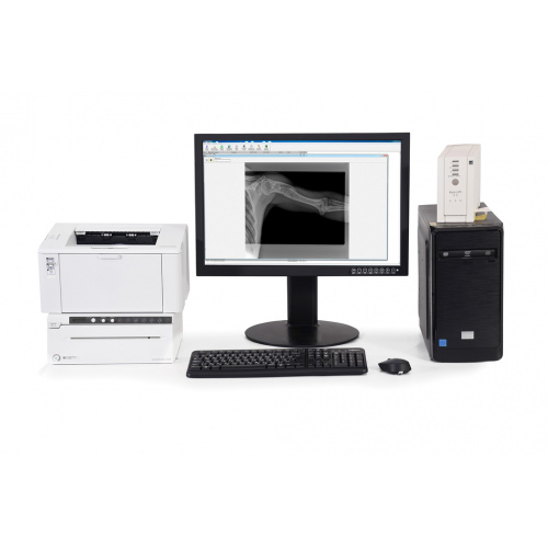 Мобильный цифровой рентгенодиагностический комплекс «Доминанта» для неонатальных исследований на базе аппарата АРА 110/160-02 с АРМ и плоскопанельным детектором