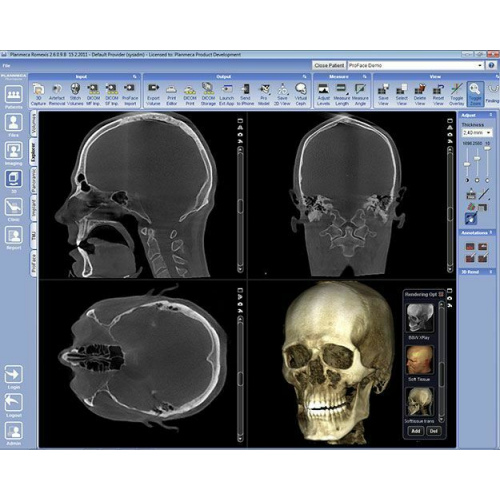 Томограф KaVo 3D eXam
