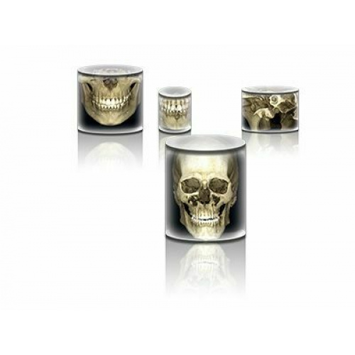 Томограф Planmeca ProMax 3D Max