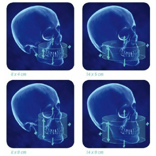 Томограф KaVo 3D eXam