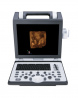 Портативный ультразвуковой сканер SIUI CTS 7700 New